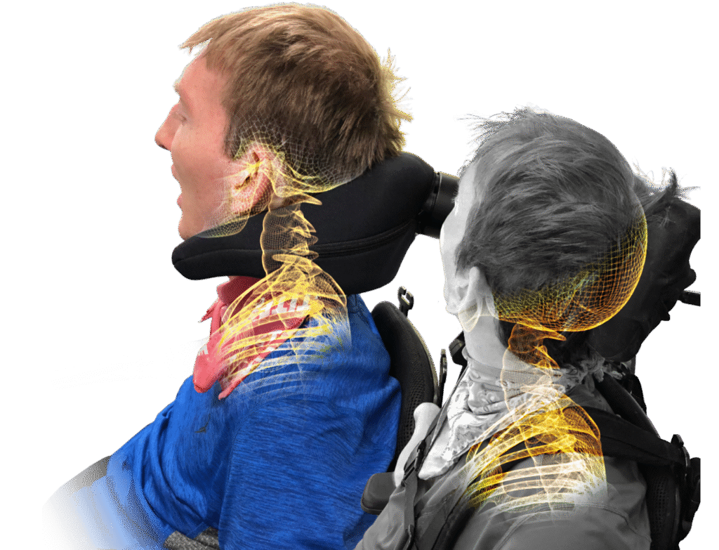 When to consider the i2i